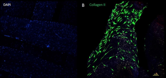 Andamio bioimpreso cultivado con células humanas a través de la bioimpresora BIO de Regemat 3D.