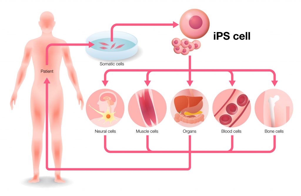 Células madre pluripotenciales inducidas (iPSCs) usando la bioimpresión de la tecnología de Regemat 3D