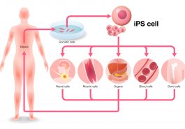 Células madre pluripotenciales inducidas (iPSCs) usando bioimpresión