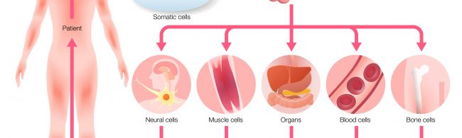 Células madre pluripotenciales inducidas (iPSCs) usando bioimpresión