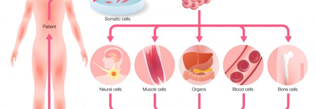 Células madre pluripotenciales inducidas (iPSCs) usando bioimpresión